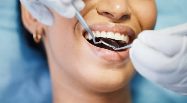 Best Cracked Tooth Emergency Dentist  in Hewitt, NJ